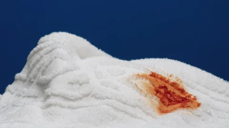 how to remove period stains from smart mattresses in winter and summer?